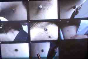 20081119164243-verrugas.jpg